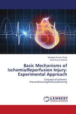 Basic Mechanisms of Ischemia/Reperfusion Injury: Experimental Approach