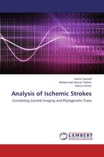 Analysis of Ischemic Strokes