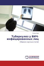 Туберкулез у ВИЧ-инфицированных лиц