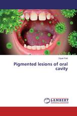 Pigmented lesions of oral cavity