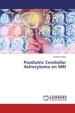 Paediatric Cerebellar Astrocytoma on MRI