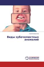 Виды зубочелюстных аномалий