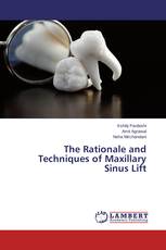 The Rationale and Techniques of Maxillary Sinus Lift