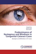 Predominance of Nystagmus and Blindness in Congenital Cataract Cases