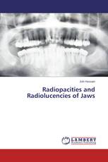 Radiopacities and Radiolucencies of Jaws