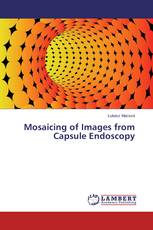 Mosaicing of Images from Capsule Endoscopy