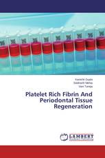 Platelet Rich Fibrin And Periodontal Tissue Regeneration