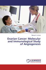 Ovarian Cancer: Molecular and Immunological Study of Angiogenesis