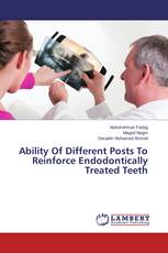 Ability Of Different Posts To Reinforce Endodontically Treated Teeth