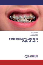 Force Delivery System In Orthodontics