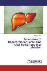 Recurrence of Hepatocellular Carcinoma After Radiofrequency ablation