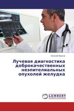 Лучевая диагностика доброкачественных неэпителиальных опухолей желудка