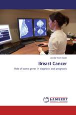 Breast Cancer