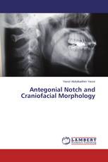 Antegonial Notch and Craniofacial Morphology