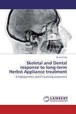 Skeletal and Dental response to long-term Herbst Appliance treatment
