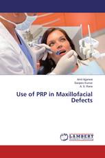 Use of PRP in Maxillofacial Defects