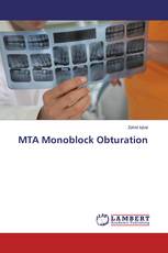 MTA Monoblock Obturation