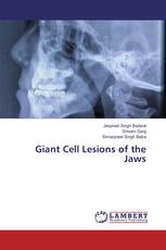 Giant Cell Lesions of the Jaws