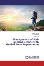 Management of Peri-implant Defects with Guided Bone Regeneration