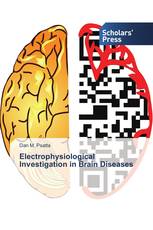 Electrophysiological Investigation in Brain Diseases