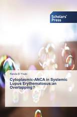 Cytoplasmic-ANCA in Systemic Lupus Erythematosus:an Overlapping?