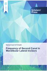 Frequency of Second Canal In Mandibular Lateral Incisors
