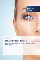 Ocular Surface Tumors