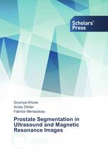 Prostate Segmentation in Ultrasound and Magnetic Resonance Images