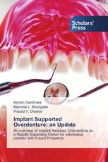 Implant Supported Overdenture: an Update