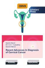 Recent Advances In Diagnosis of Cervical Cancer