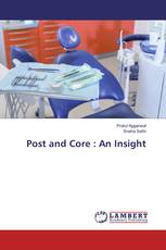 Post and Core : An Insight