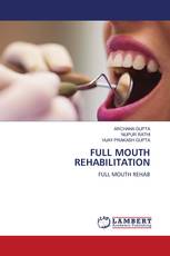 FULL MOUTH REHABILITATION