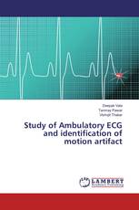 Study of Ambulatory ECG and identification of motion artifact