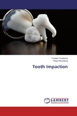 Tooth Impaction