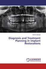Diagnosis and Treatment Planning in Implant Restorations
