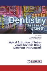 Apical Extrusion of Intra-canal Bacteria Using Different Instruments