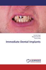 Immediate Dental Implants