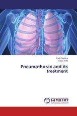 Pneumothorax and its treatment