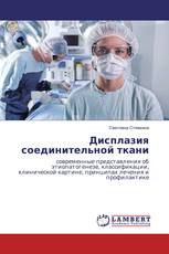 Дисплазия соединительной ткани