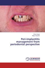 Peri-implantitis management from periodontal perspective