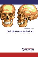 Oral fibro osseous lesions