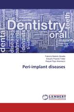 Peri-implant diseases