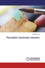 Porcelain laminate veneers