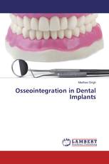 Osseointegration in Dental Implants