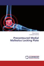 Precontoured Medial Malleolus Locking Plate