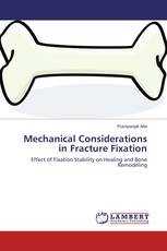 Mechanical Considerations in Fracture Fixation