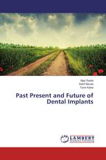 Past Present and Future of Dental Implants