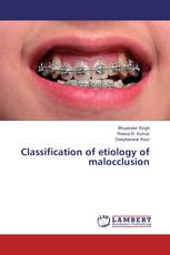 Classification of etiology of malocclusion