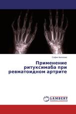 Применение ритуксимаба при ревматоидном артрите