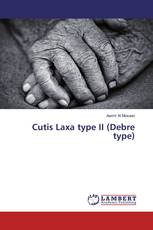 Cutis Laxa type II (Debre type)